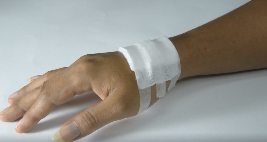 A hand bandaged with sterile white gauze and tape